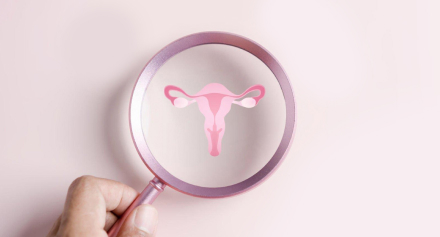 Image representing Understanding Polycystic Ovary Syndrome (PCOS) in Adolescent Girls: Symptoms, Early Diagnosis and Management Strategies