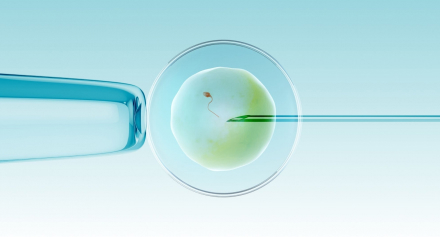 Image representing Understanding IVF: The Process, Benefits, and Risks Explained
