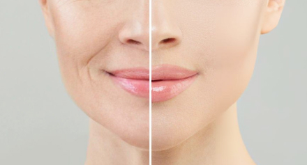 Image representing Menopause and Skin Changes: What You Need to Know