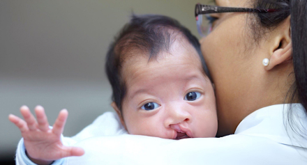 Image representing Transforming Young Lives: Common Paediatric Plastic Surgery Procedures